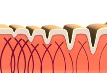 Collagen: what it is and what it is for