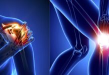 How to avoid wear and tear and improve joint health? joint nutrition supplements