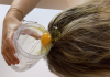 Top 10 Tips for Thinning Hair hair loss treatment for female