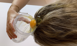 hair loss treatment for female