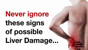 10 Signs of Liver Damage and When to See a Doctor