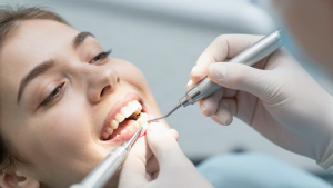 Dentist sculpting tooth-colored resin on a front tooth