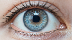 Close-up of a human eye before LASIK surgery